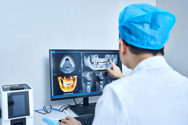 Best Emergency Tooth Extraction in Ava, MO